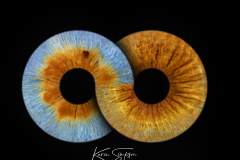 Inifinity-Iris-Eye-Photo