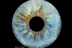 Single-Eye-Iris-Photography