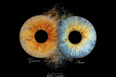 eye-two-collison-scotland